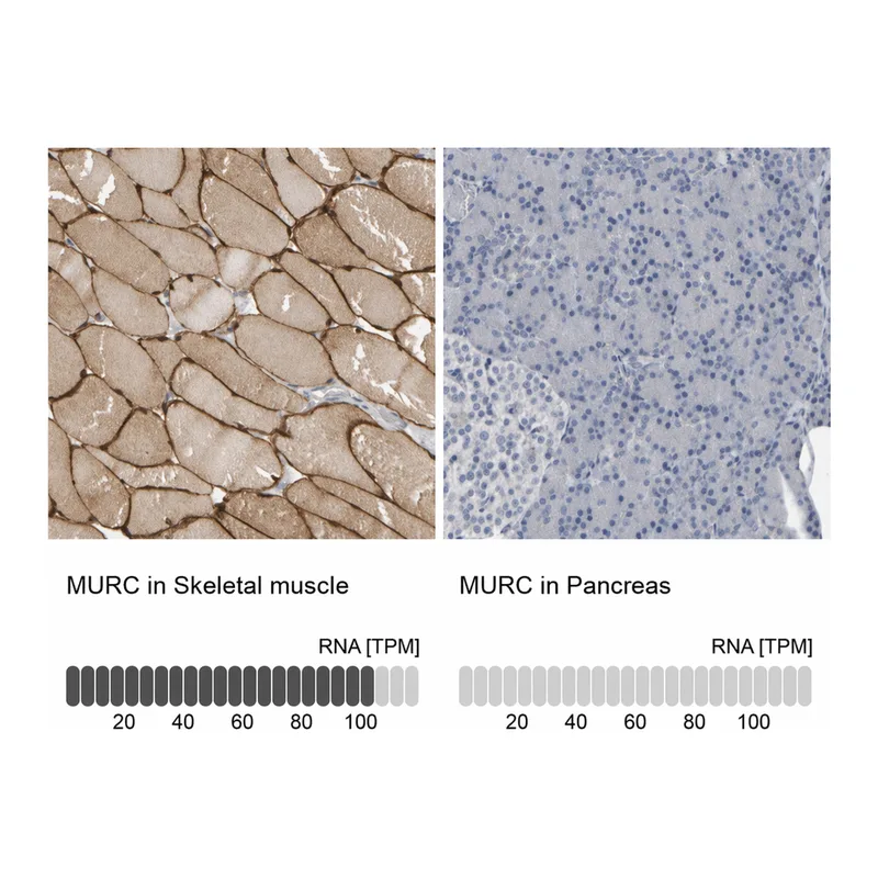 Atlas Antibodies Anti-MURC Antibody
