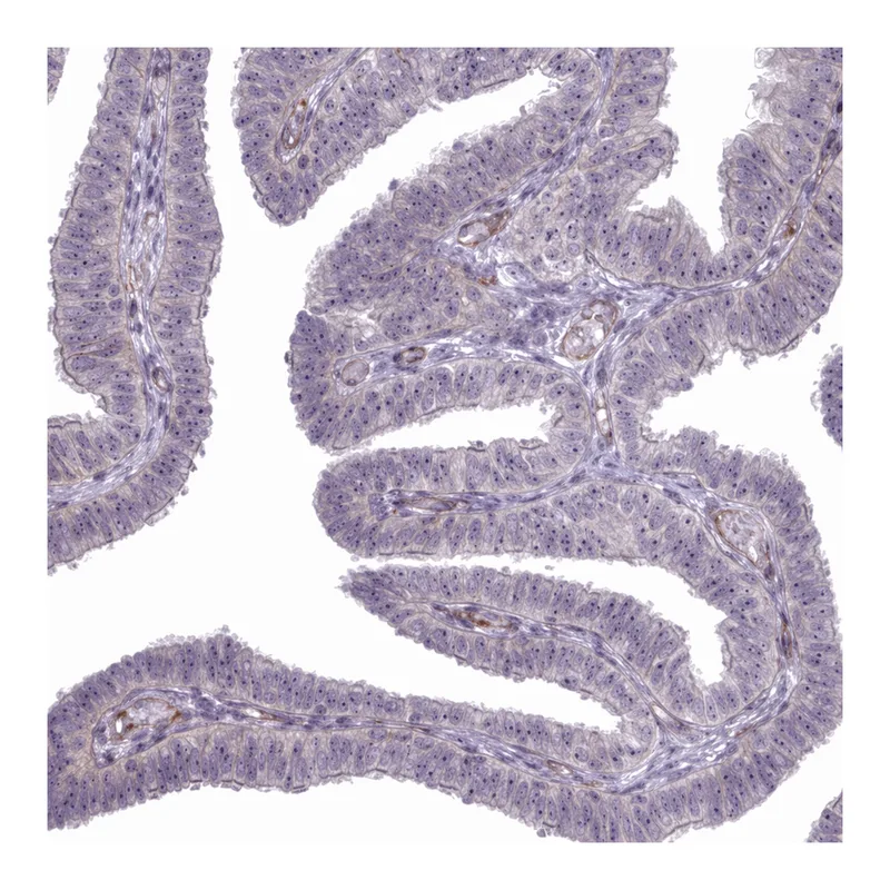 Atlas Antibodies Anti-MUS81 Antibody