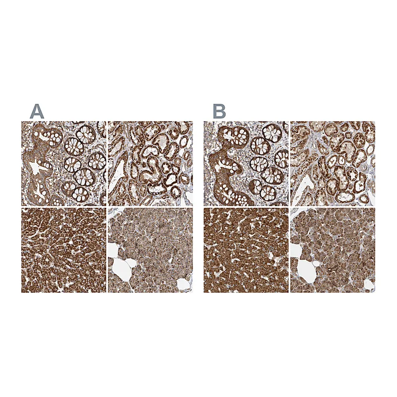 Atlas Antibodies Anti-MUT Antibody
