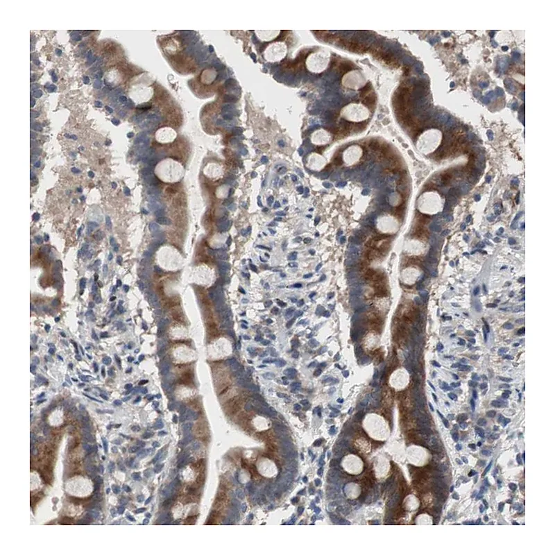 Atlas Antibodies Anti-MUTYH Antibody
