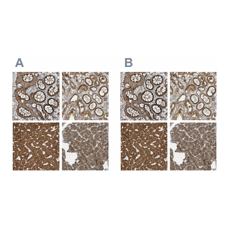 Atlas Antibodies Anti-MUT Antibody