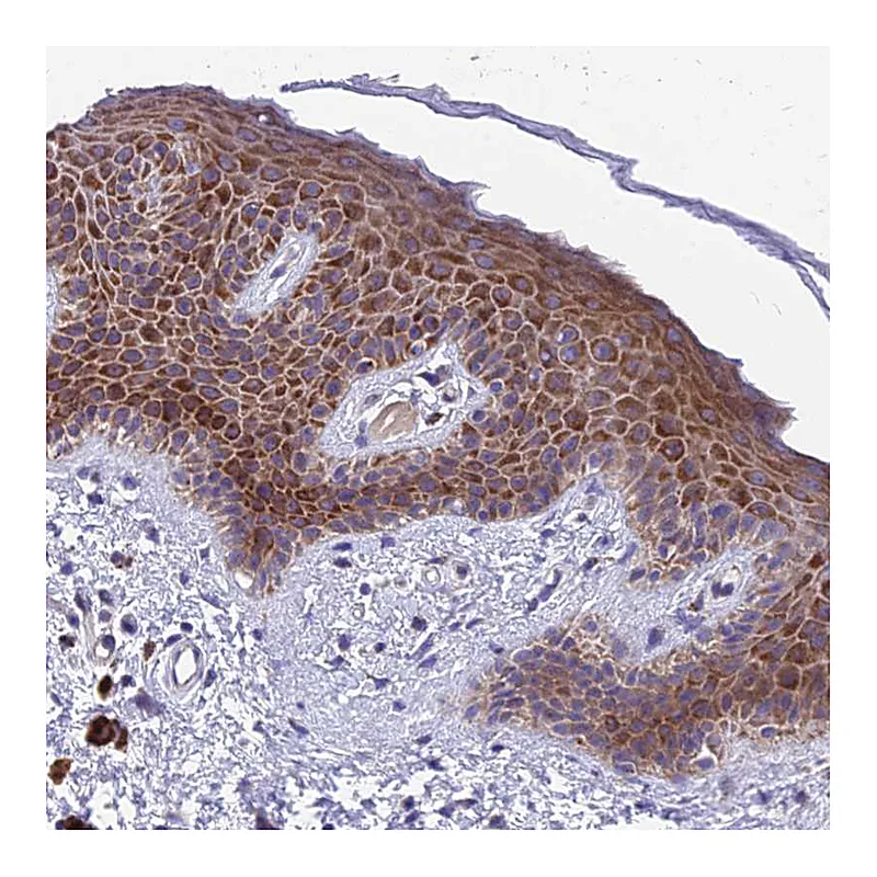 Atlas Antibodies Anti-MVB12A Antibody