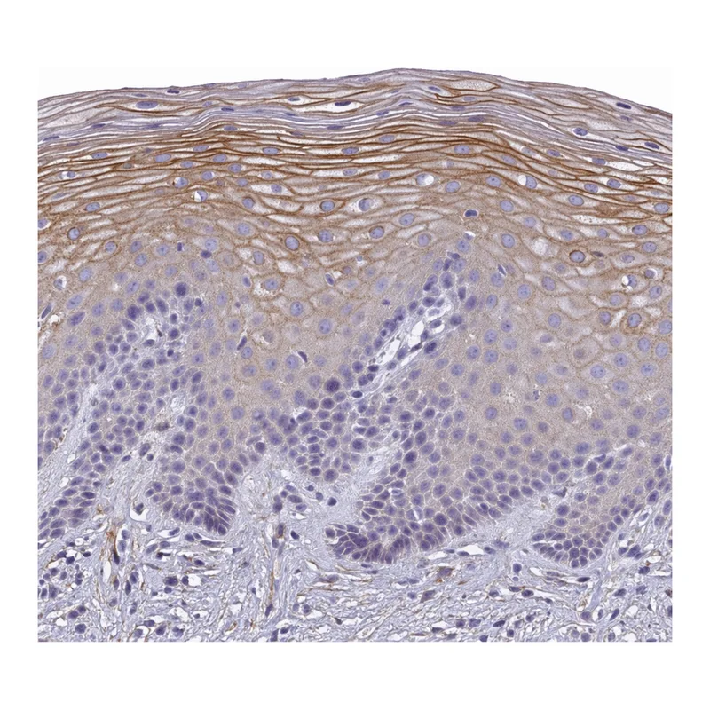 Atlas Antibodies Anti-MVB12A Antibody