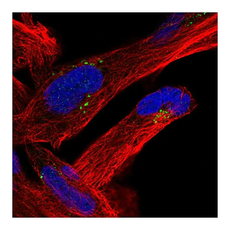 Atlas Antibodies Anti-MVB12B Antibody