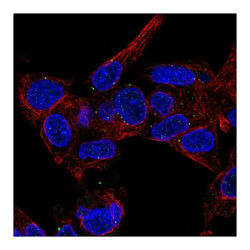 Atlas Antibodies Anti-MVB12B Antibody