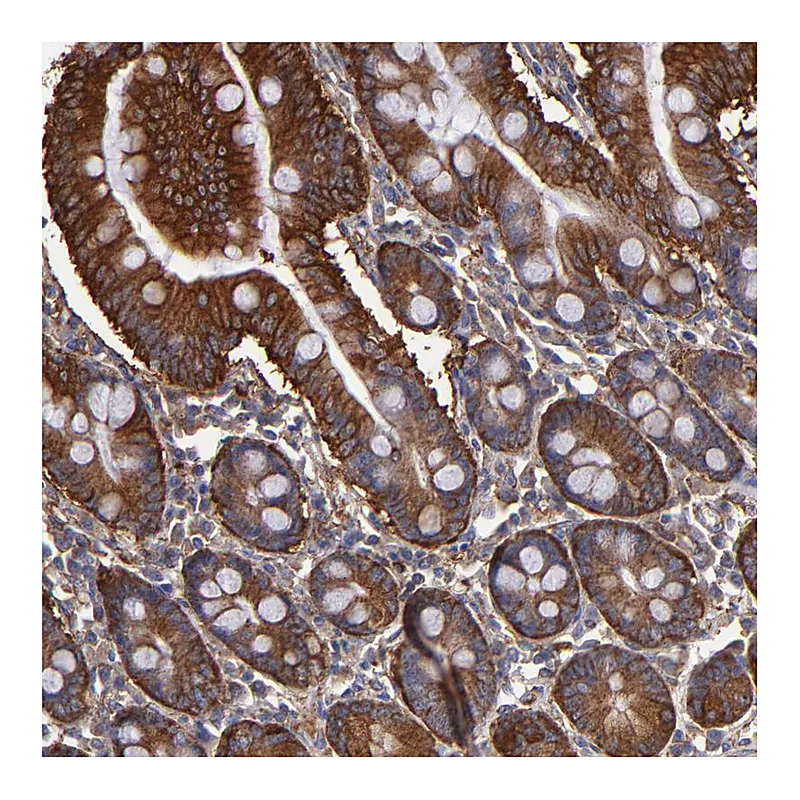 Atlas Antibodies Anti-MVP Antibody