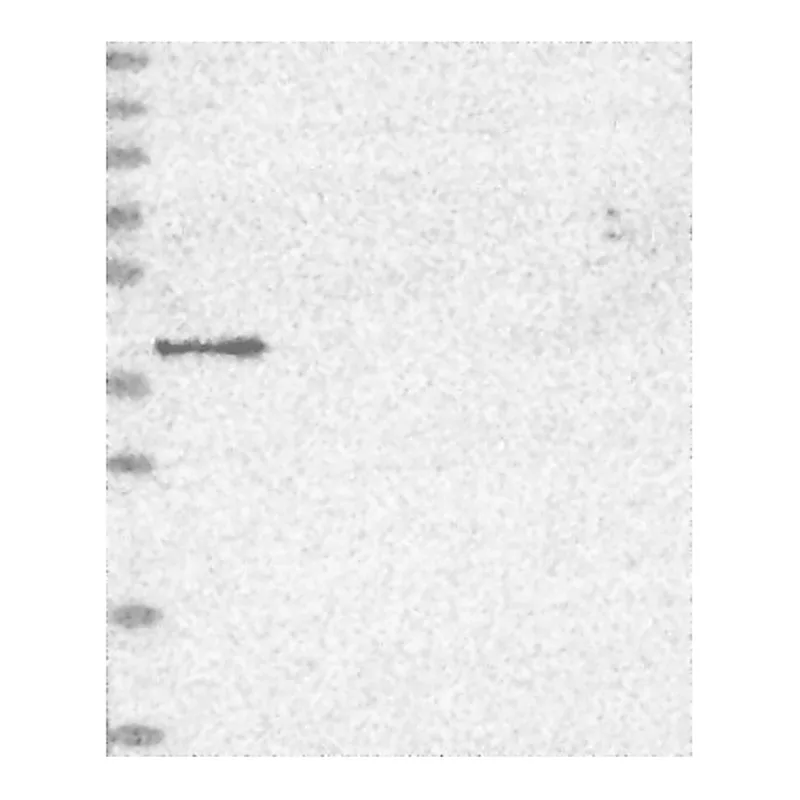 Atlas Antibodies Anti-MVK Antibody