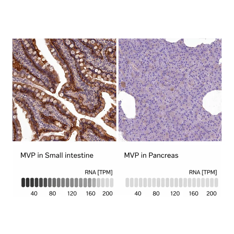 Atlas Antibodies Anti-MVP Antibody