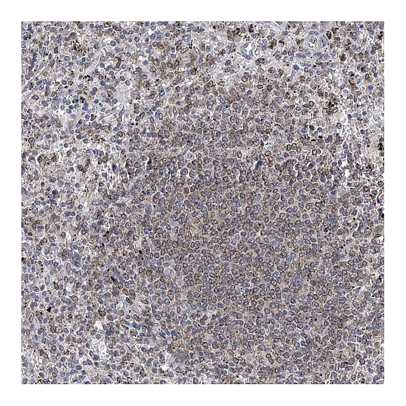 Atlas Antibodies Anti-MX2 Antibody