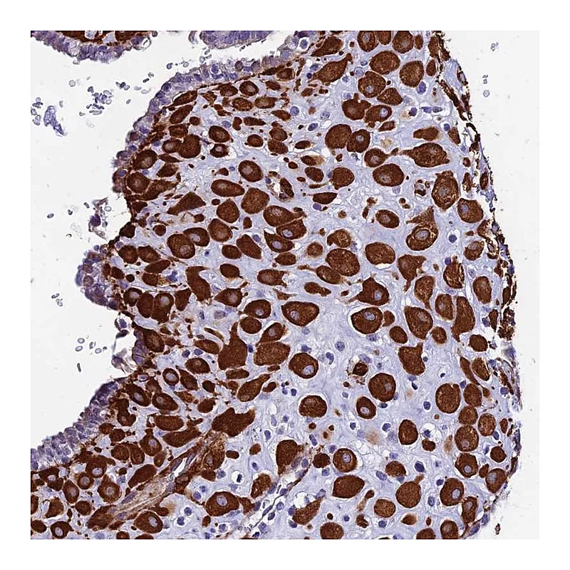 Atlas Antibodies Anti-MXRA7 Antibody
