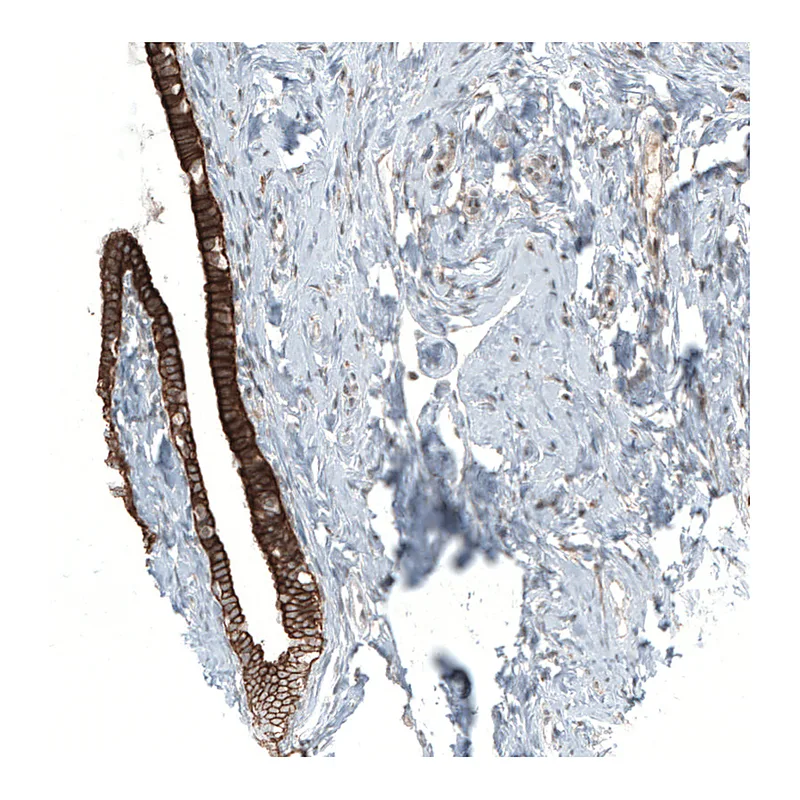 Atlas Antibodies Anti-MXRA8 Antibody
