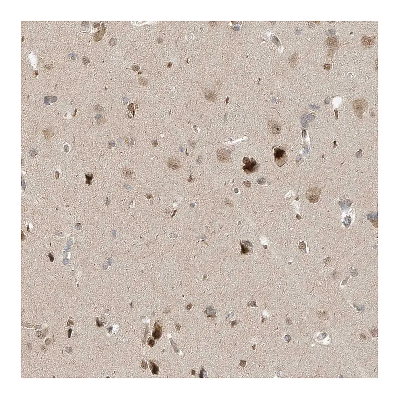Atlas Antibodies Anti-MXI1 Antibody
