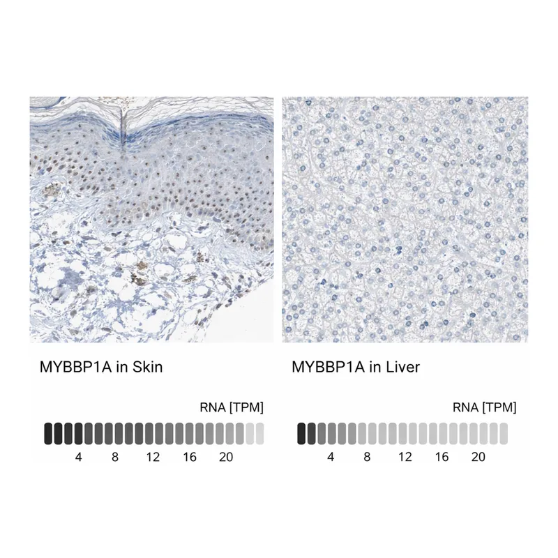 Atlas Antibodies Anti-MYBBP1A Antibody