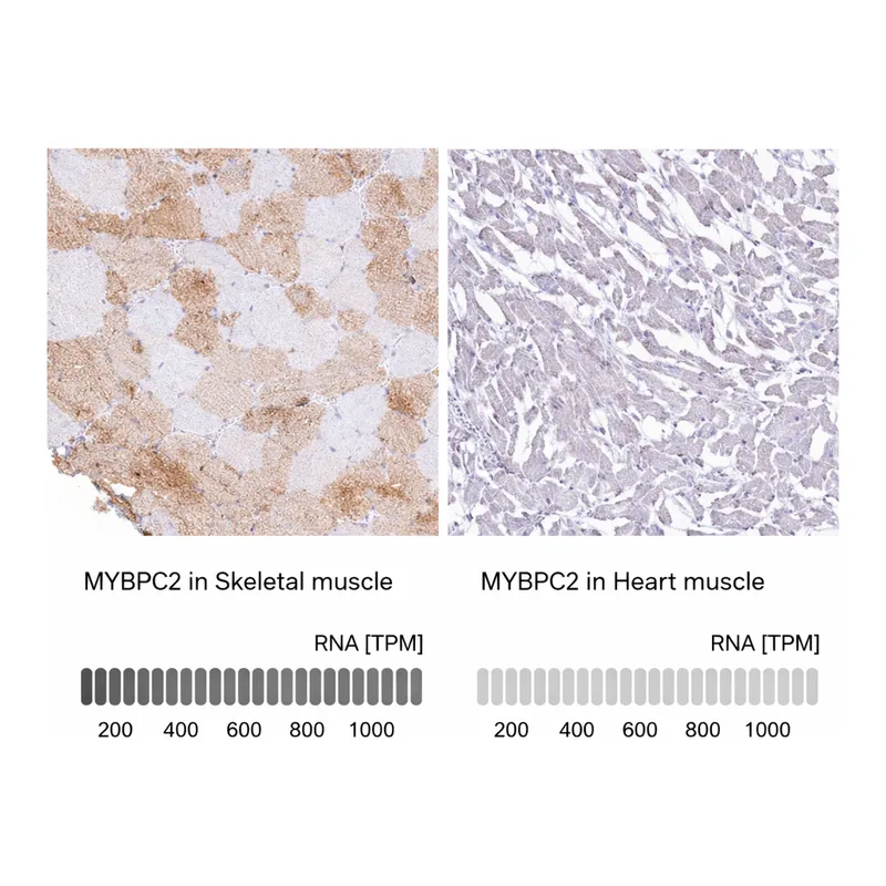 Atlas Antibodies Anti-MYBPC2 Antibody
