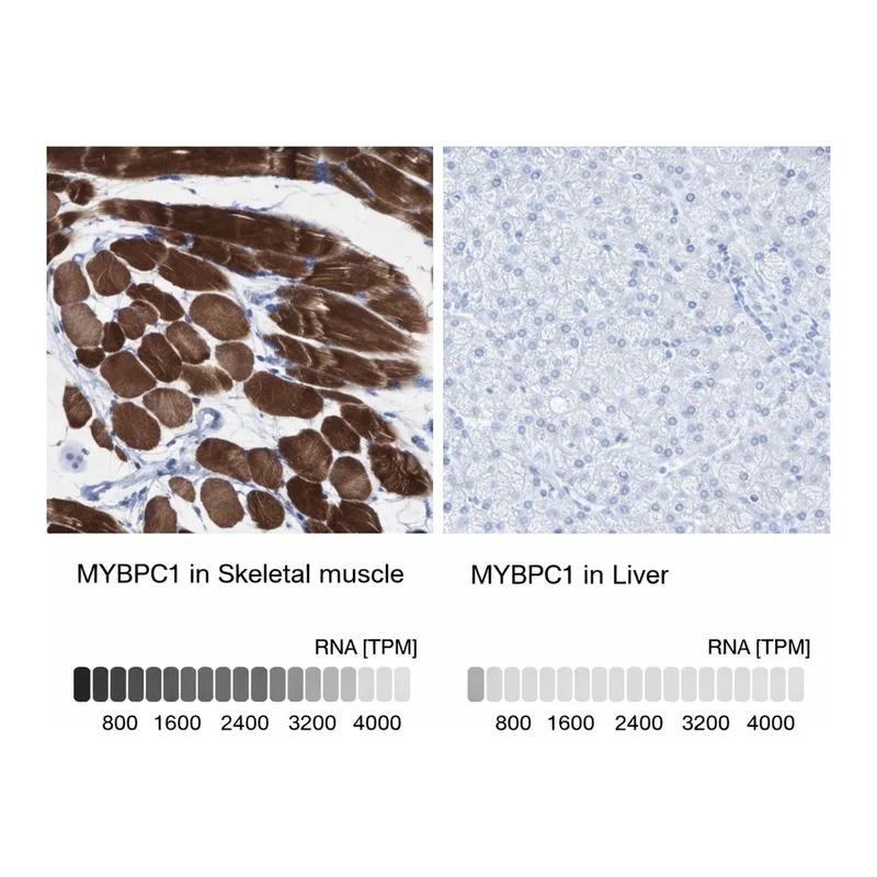 Atlas Antibodies Anti-MYBPC1 Antibody