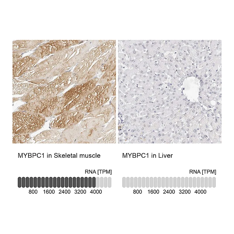 Atlas Antibodies Anti-MYBPC1 Antibody