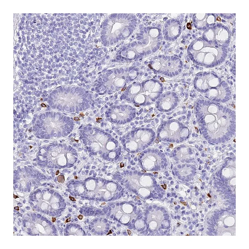 Atlas Antibodies Anti-MYADML2 Antibody