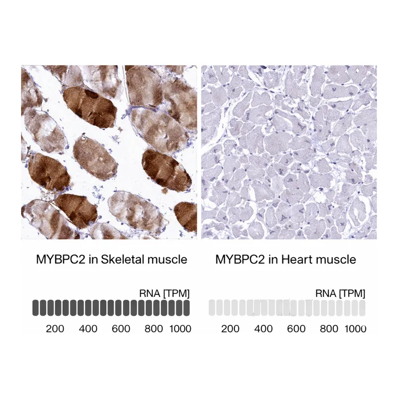 Atlas Antibodies Anti-MYBPC2 Antibody