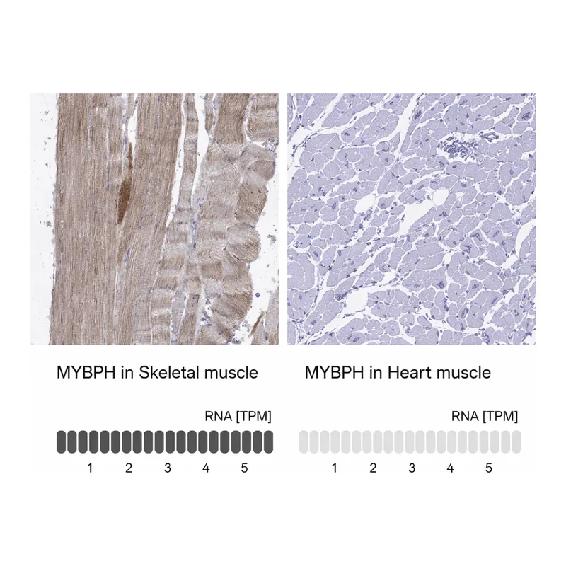 Atlas Antibodies Anti-MYBPH Antibody