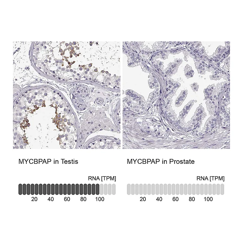 Atlas Antibodies Anti-MYCBPAP Antibody