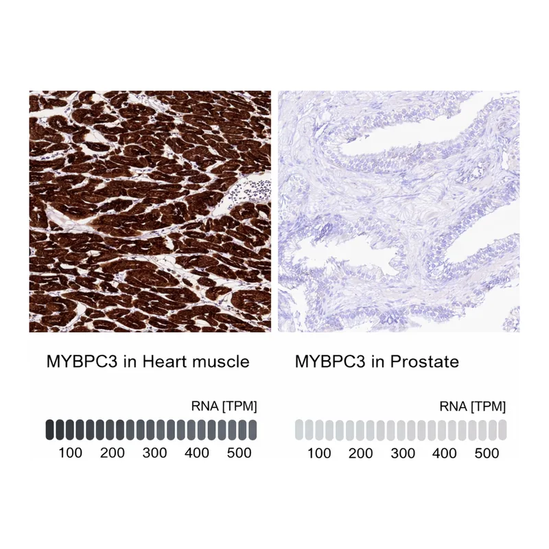 Atlas Antibodies Anti-MYBPC3 Antibody