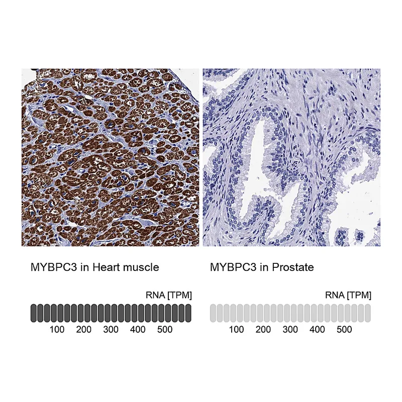 Atlas Antibodies Anti-MYBPC3 Antibody