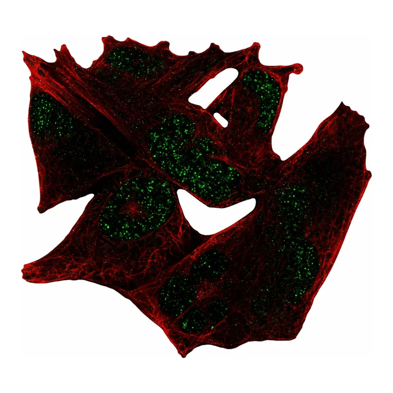 Atlas Antibodies Anti-MYCL Antibody