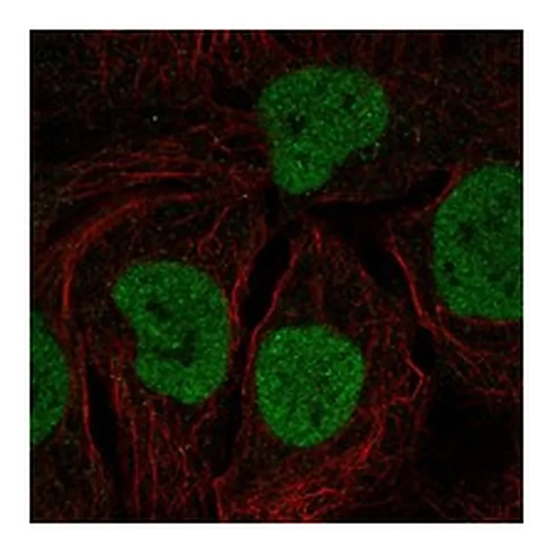 Atlas Antibodies Anti-MYCL Antibody