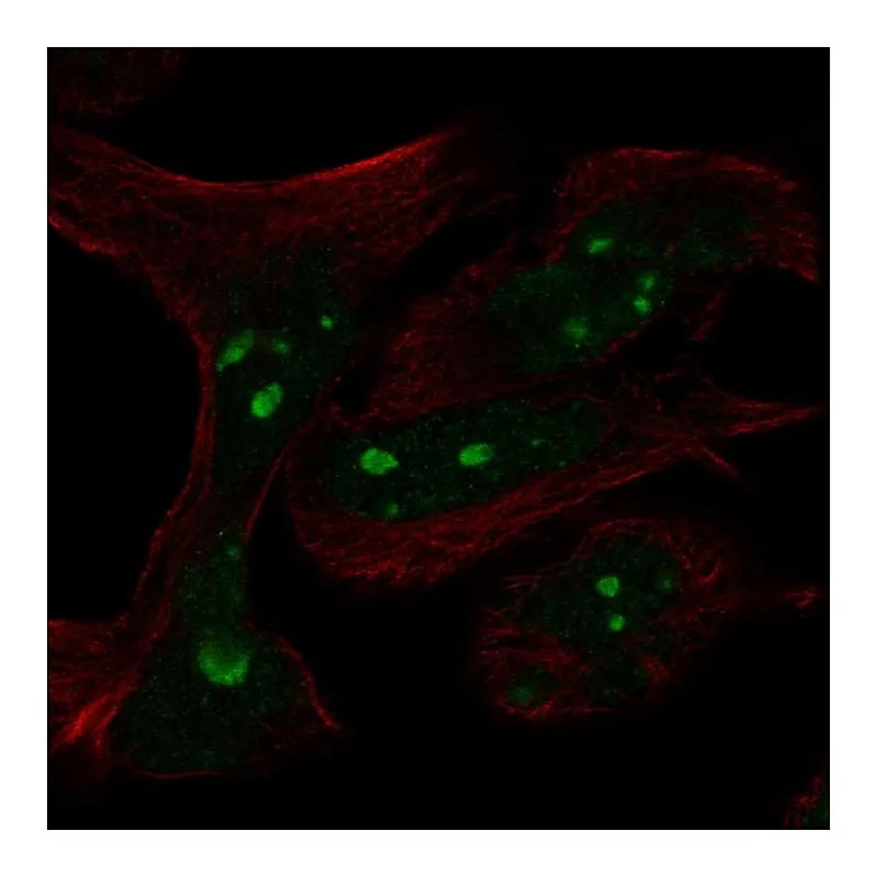 Atlas Antibodies Anti-MYCN Antibody
