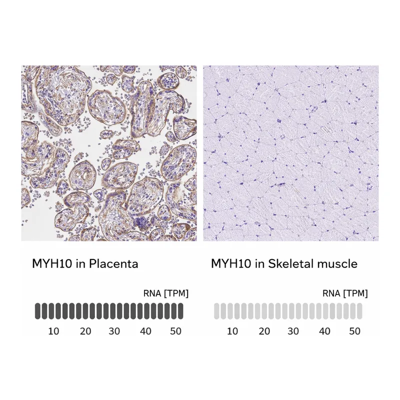 Atlas Antibodies Anti-MYH10 Antibody