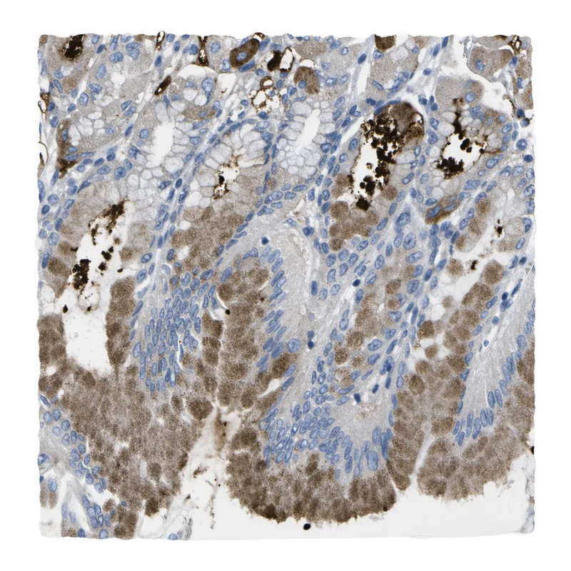 Atlas Antibodies Anti-MYEOV Antibody