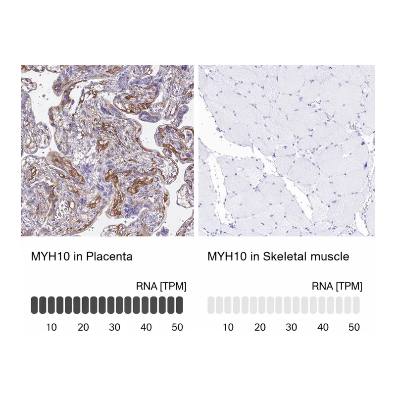 Atlas Antibodies Anti-MYH10 Antibody