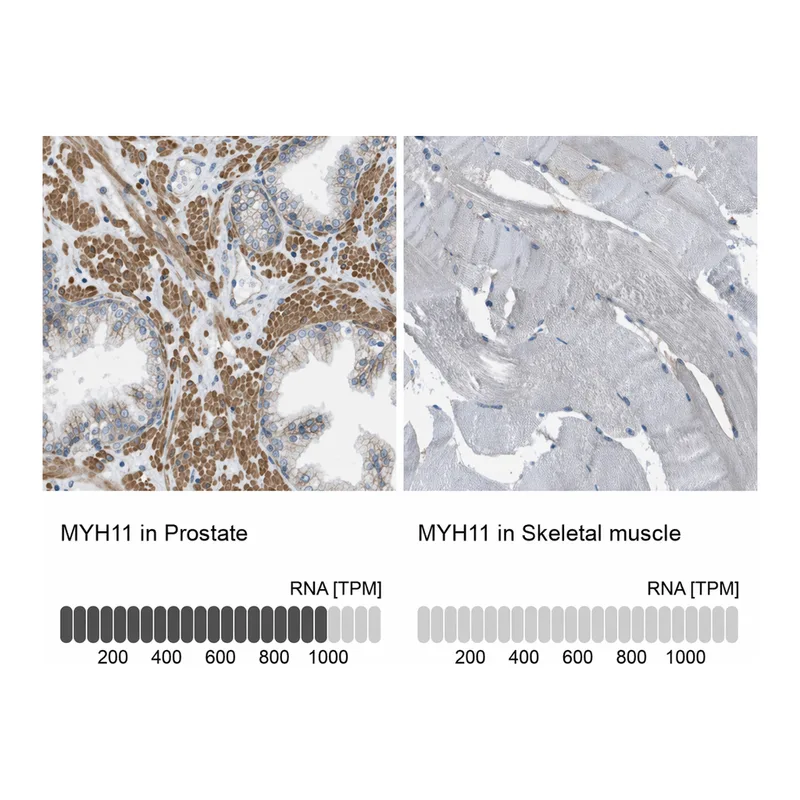 Atlas Antibodies Anti-MYH11 Antibody