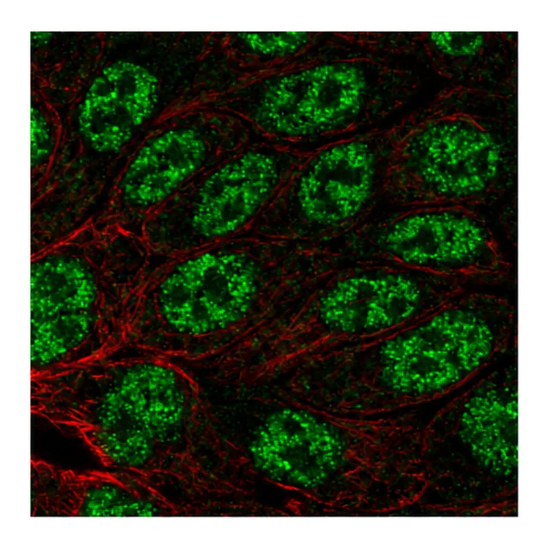 Atlas Antibodies Anti-MYH14 Antibody