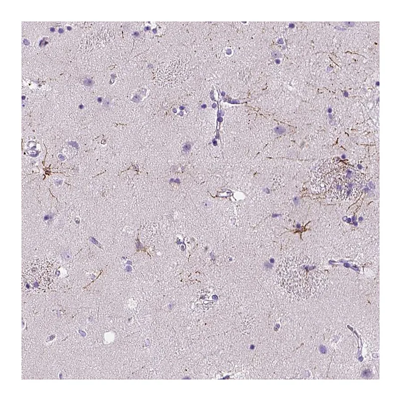 Atlas Antibodies Anti-MYH15 Antibody