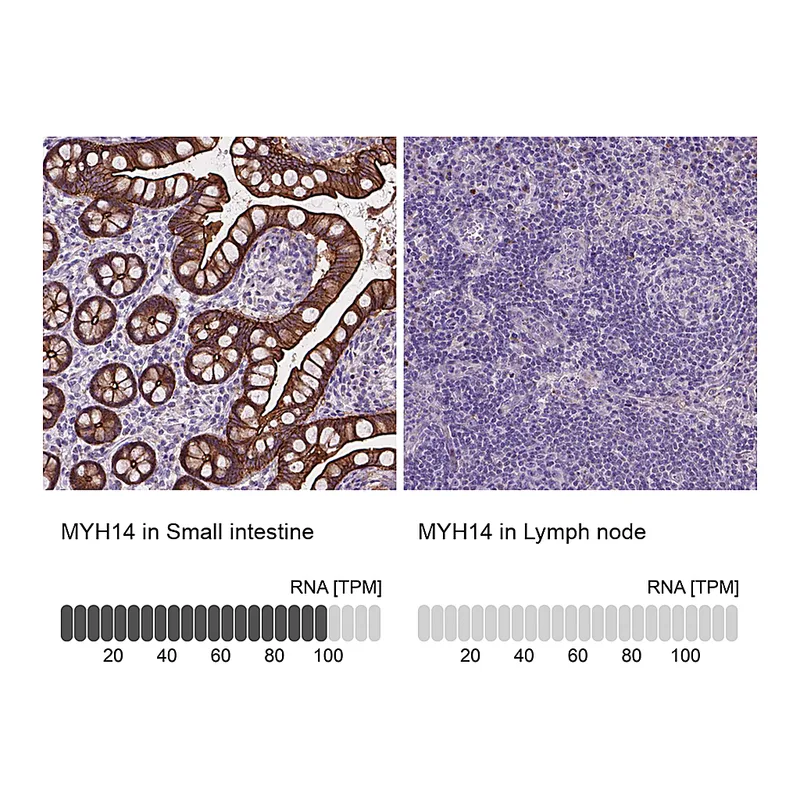 Atlas Antibodies Anti-MYH14 Antibody
