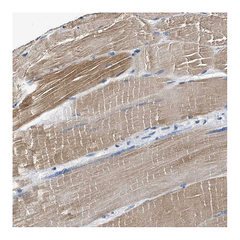 Atlas Antibodies Anti-MYH3 Antibody