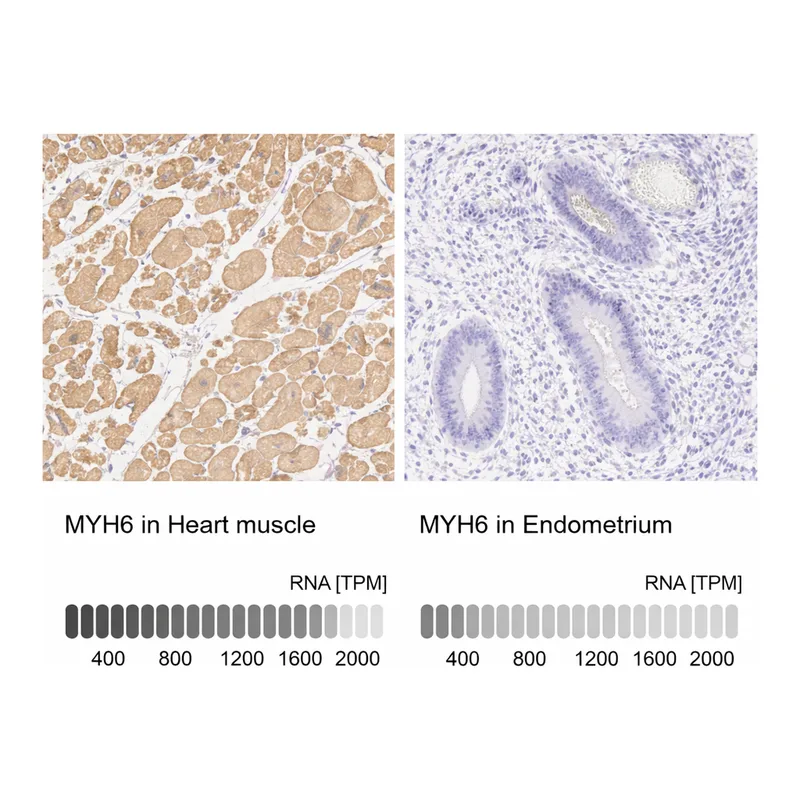 Atlas Antibodies Anti-MYH6 Antibody