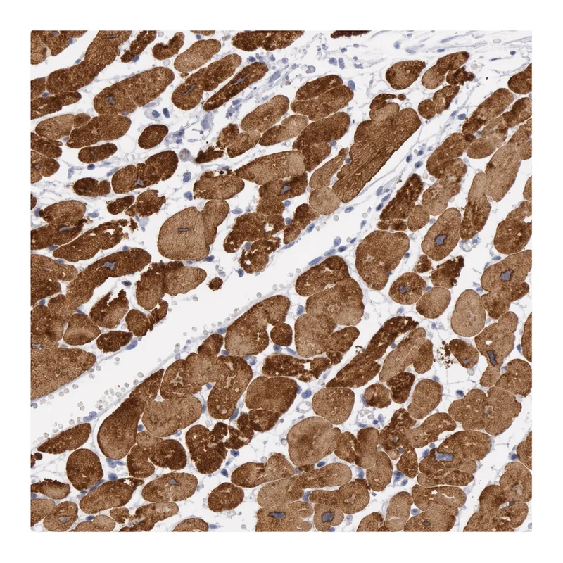 Atlas Antibodies Anti-MYH7 Antibody