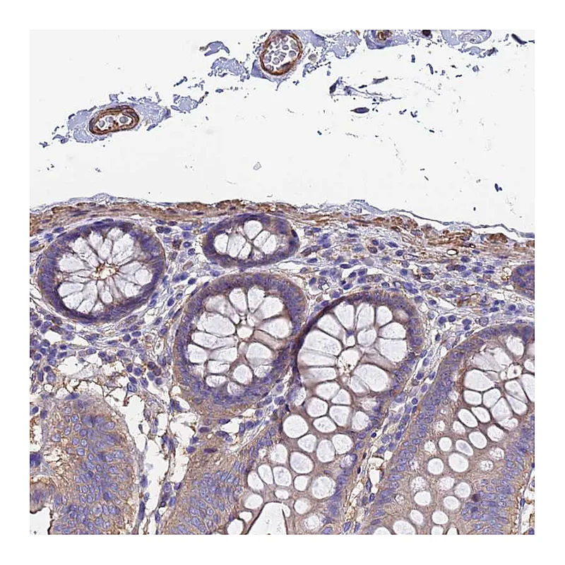 Atlas Antibodies Anti-MYL12B Antibody