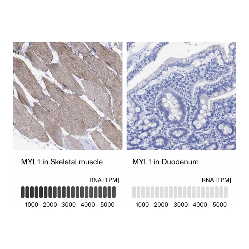 Atlas Antibodies Anti-MYL1 Antibody