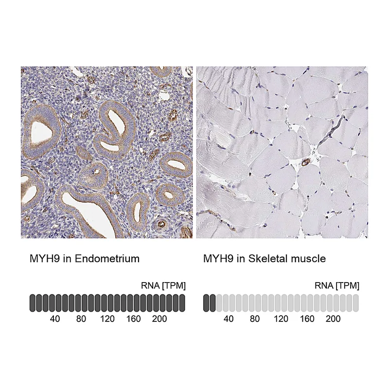 Atlas Antibodies Anti-MYH9 Antibody