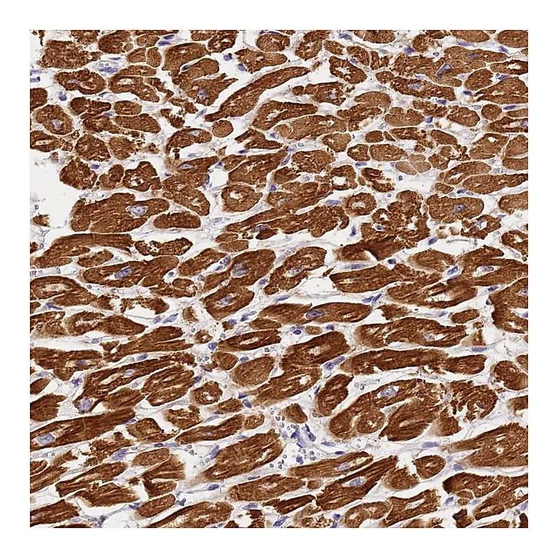 Atlas Antibodies Anti-MYL2 Antibody