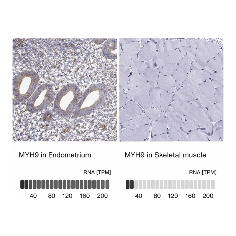 Atlas Antibodies Anti-MYH9 Antibody