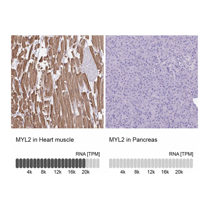 Atlas Antibodies Anti-MYL2 Antibody