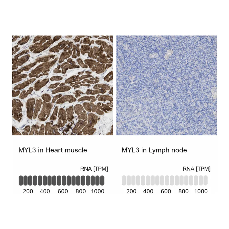 Atlas Antibodies Anti-MYL3 Antibody
