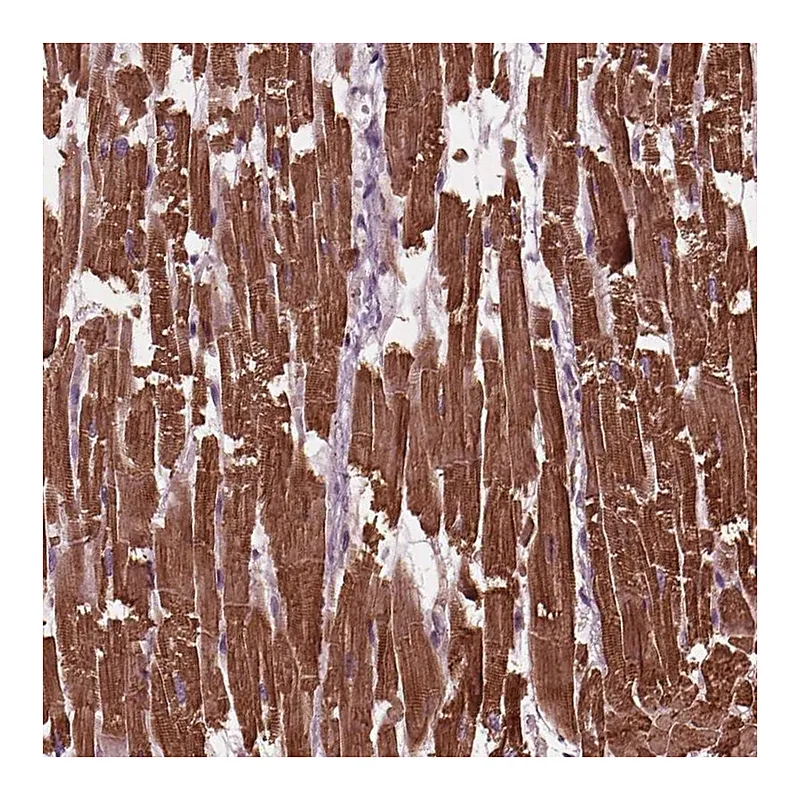 Atlas Antibodies Anti-MYL3 Antibody