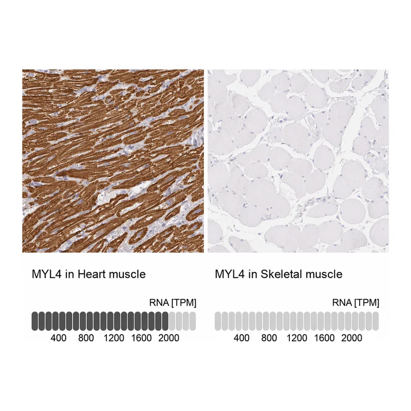 Atlas Antibodies Anti-MYL4 Antibody