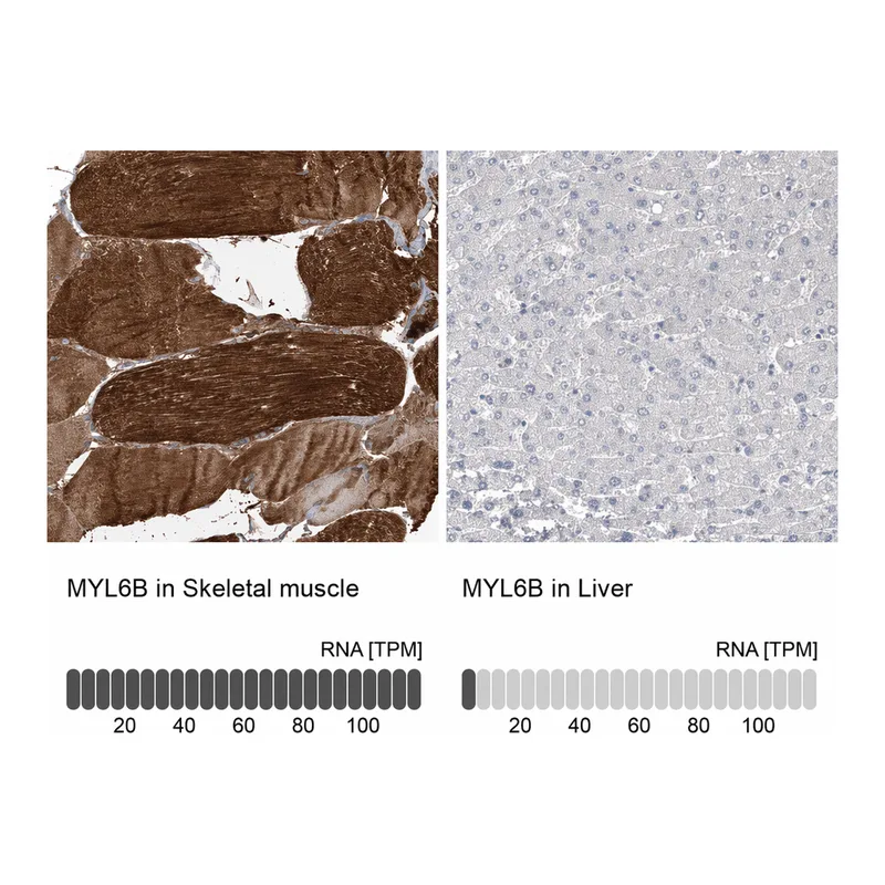 Atlas Antibodies Anti-MYL6B Antibody