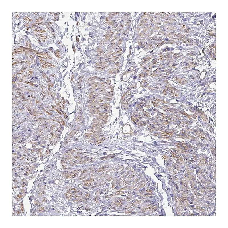 Atlas Antibodies Anti-MYL6 Antibody